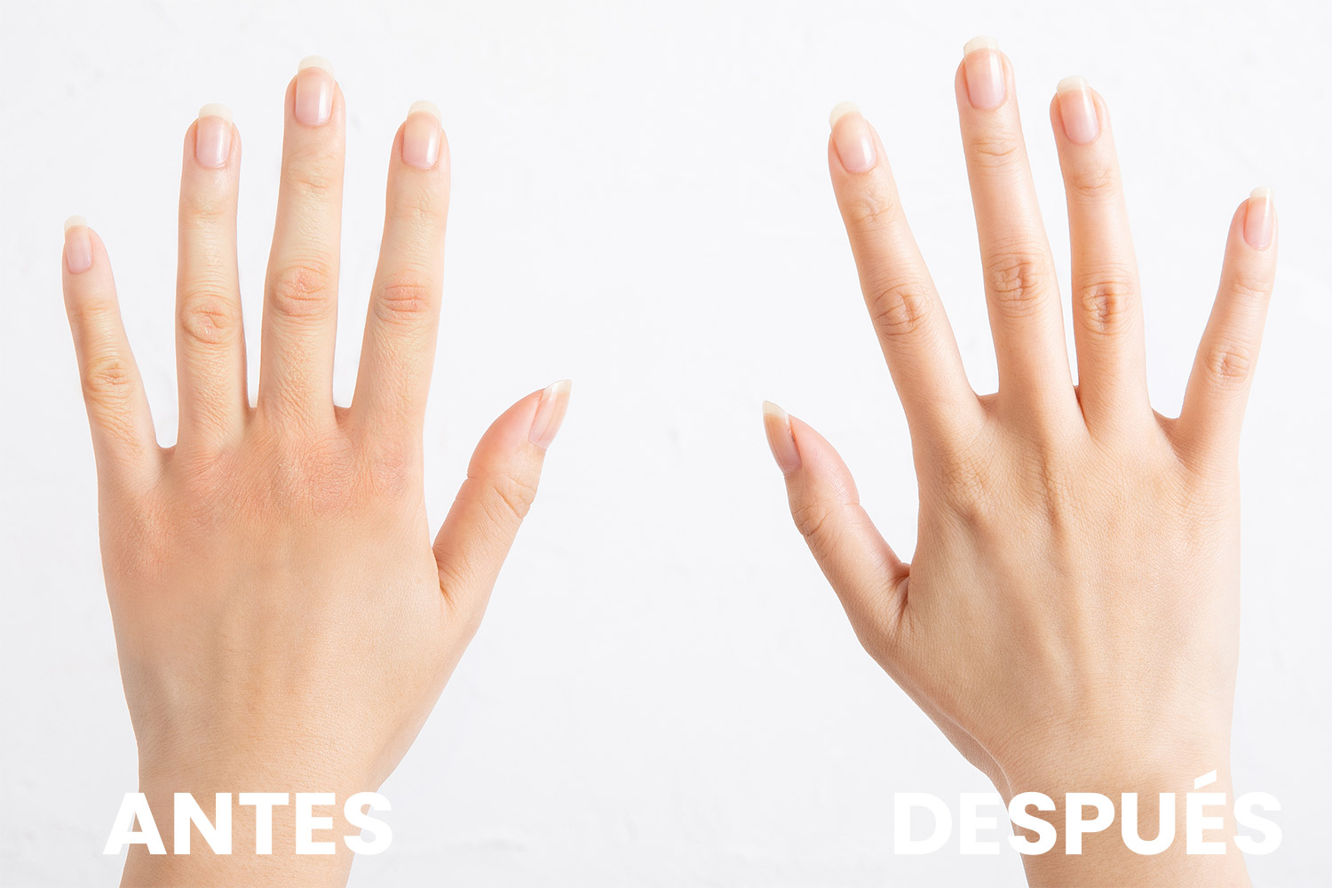 Antes y después del uso de un correcto tratamiento para las manos