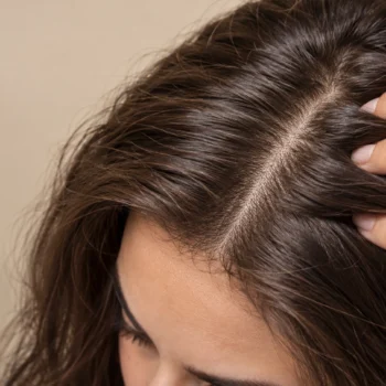 skinification capilar cuero cabelludo Cuero cabelludo de una mujer
